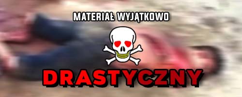 Agonia po ataku maczetą