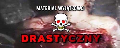 Obdzieranie ze skóry