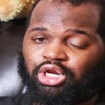 Devyn Holmes i postrzał w głowę – rok po wypadku.