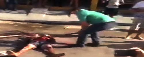 Skopany publicznie po głowie