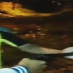 Dłoń tego dzieciaka, została przestrzelona za karę.