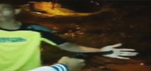 Dłoń przestrzelona pistoletem