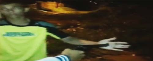 Dłoń przestrzelona pistoletem